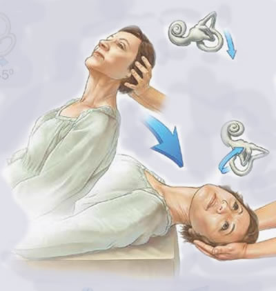 Rehabilitación Vestibular – Kinesiarte